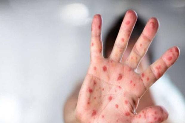 Sabirabadda bir yaşlı körpə xəstəxanada ÖLDÜ