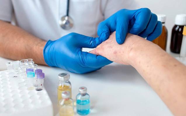 Bu ölkədə qızılca epidemiya elan edildi 