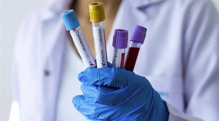 Yoluxma sayı açıqlandı - SON STATİSTİKA