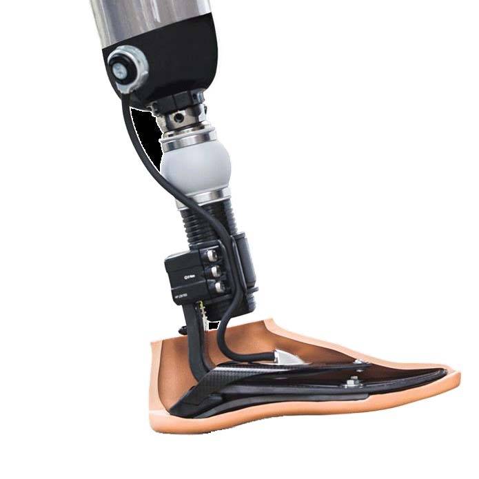 \"432 hərbçi yüksək texnologiyalı protezlə təmin edilib\" - ƏƏSMN