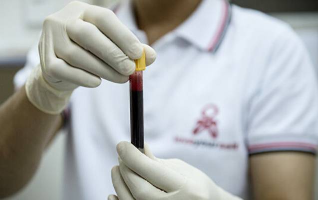 Azərbaycanda QİÇS xəstələrinin sayı AÇIQLANDI