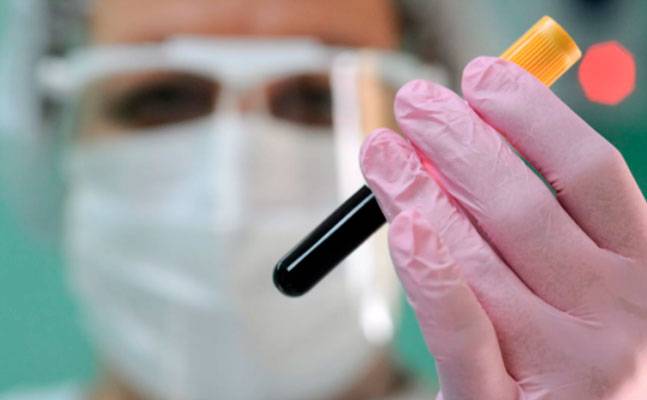 Aktiv koronavirus xəstələrinin sayı 39-a çatdı