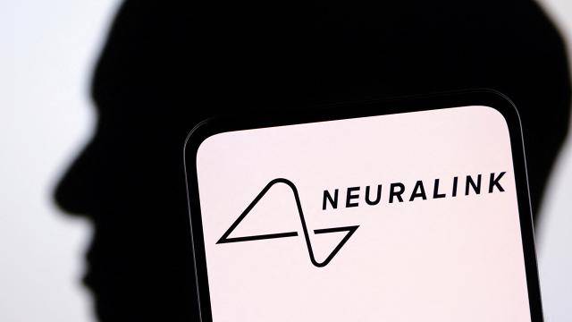 Maskın beyin implantı şirkəti insan sınaqları üçün tərəfdaşlar axtarır