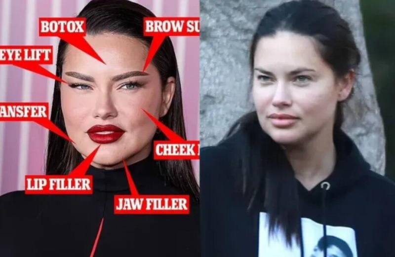 Paparasilər məşhur modelin yalanını üzə çıxardı - Foto