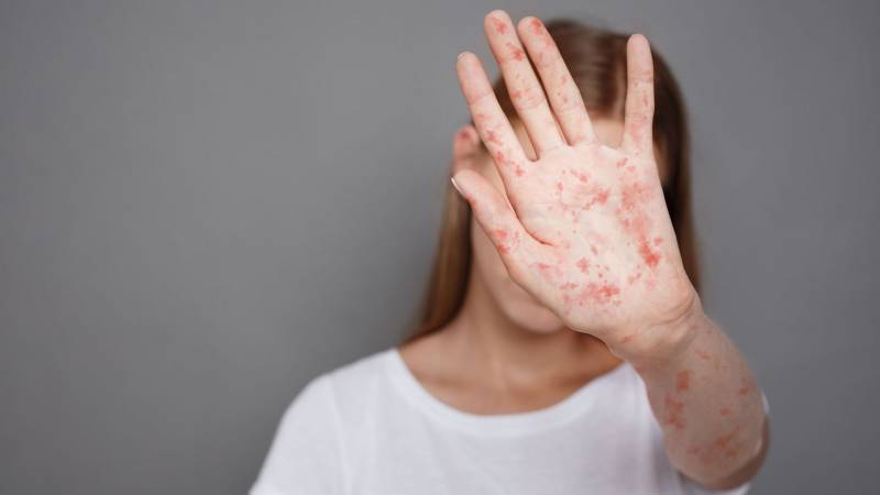 Azərbaycanda xəstəlik təhlükəsi artır - XƏBƏRDARLIQ