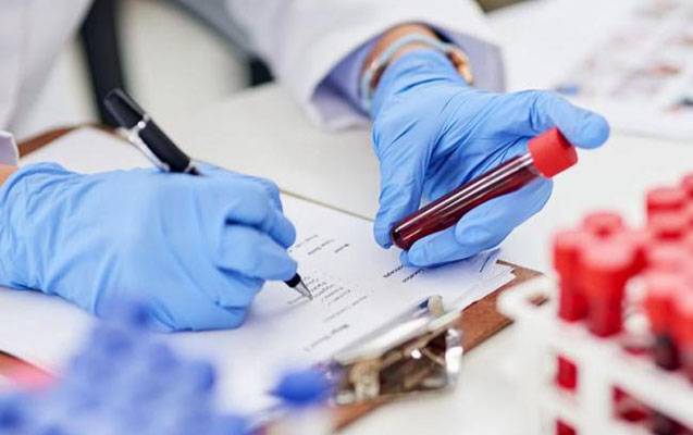 Son 1 ayda Azərbaycanda koronavirusa yoluxma artıb