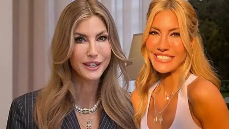 Çağla Şikelin dodaqlarındakı dəyişiklik gündəm oldu - FOTO