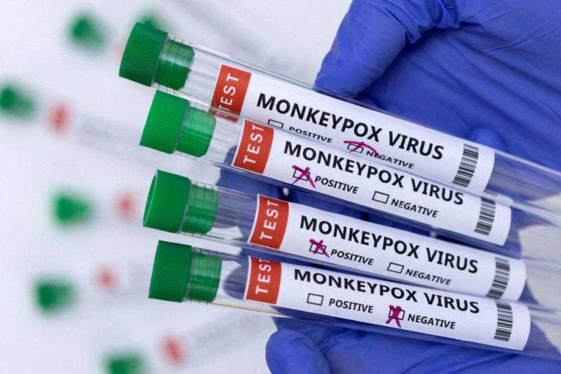 Azərbaycana meymunçiçəyi testləri gətirildi 