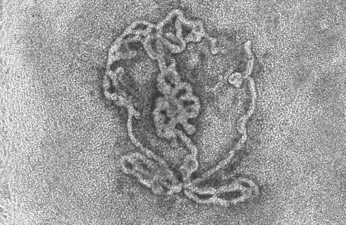 İsrail alimləri kişi sonsuzluğuna əhəmiyyətli təsir edəcək testislər düzəltdi