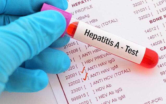 Nazirlik Hepatit A virusu ilə bağlı məlumat yaydı
