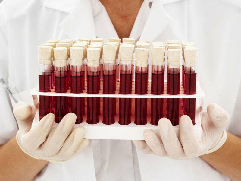 Orqanizmdə niyə dəmir yoxdur? - 3 ən ümumi SƏBƏB