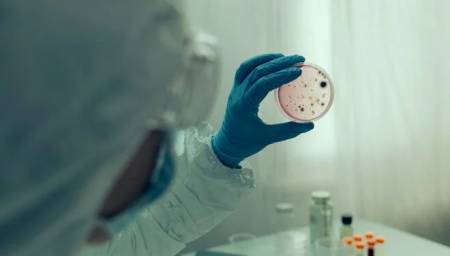 Dünyada vəba xəstəliyinə yoluxma halları artdı - ÜST