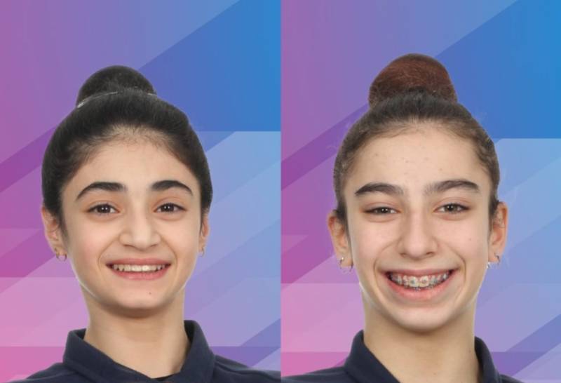 İdmançılarımız Almaniyada 2 medal qazandı 