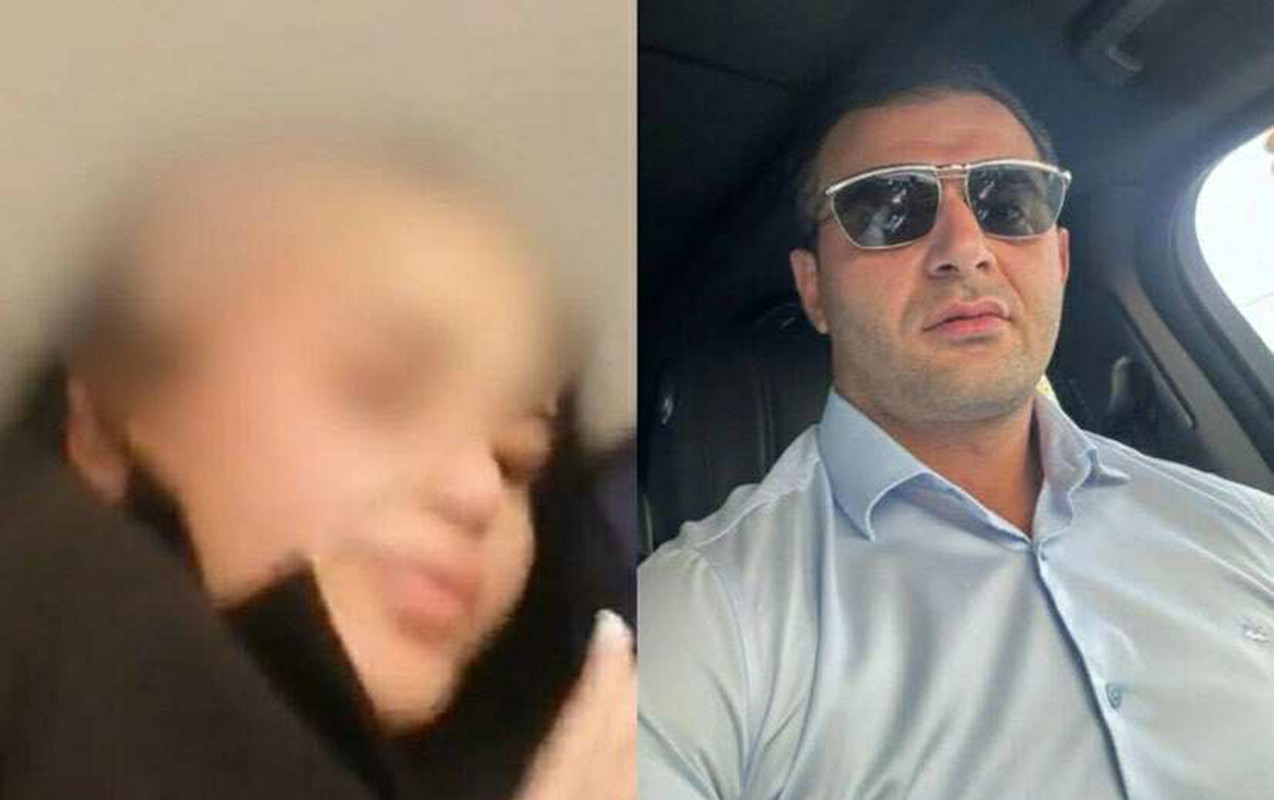 Arvadının saçını keçəl edən ər həbs olundu