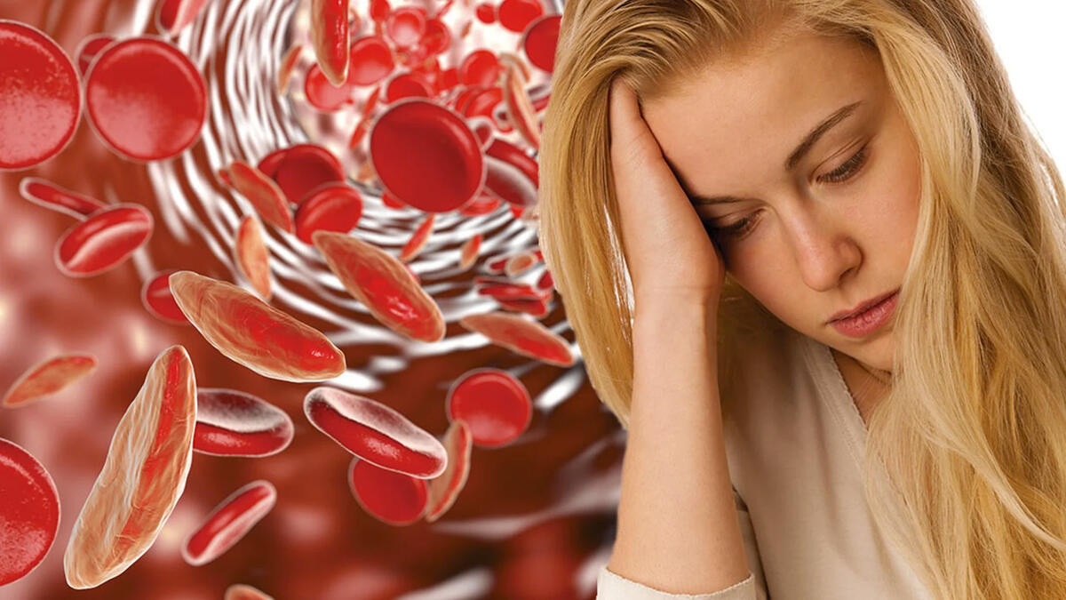Anemiya yarada biləcək xəstəlik açıqlandı