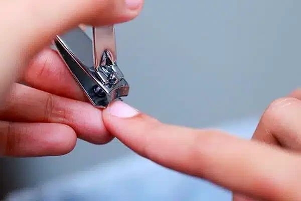 Dırnaqlarda rəng dəyişimi nəyin əlamətidir?
