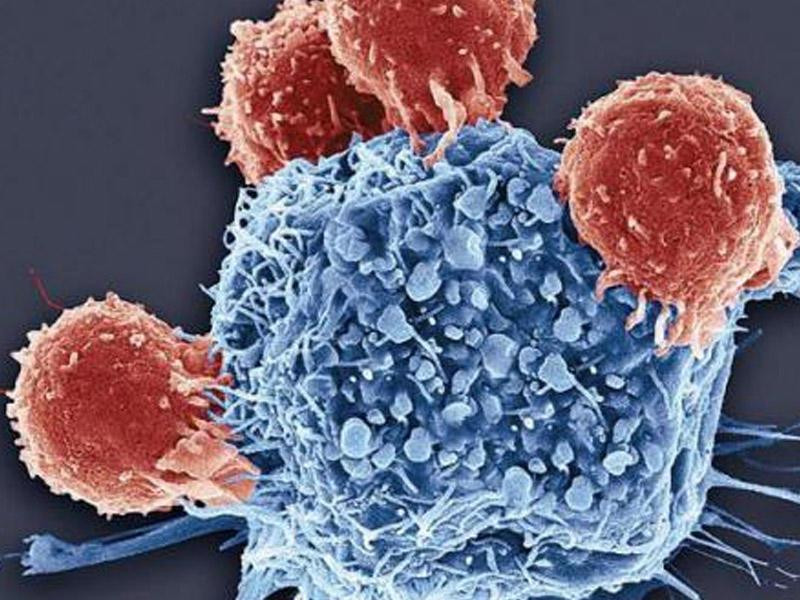 Xərçəngə qarşı yeni üsul kəşf edildi