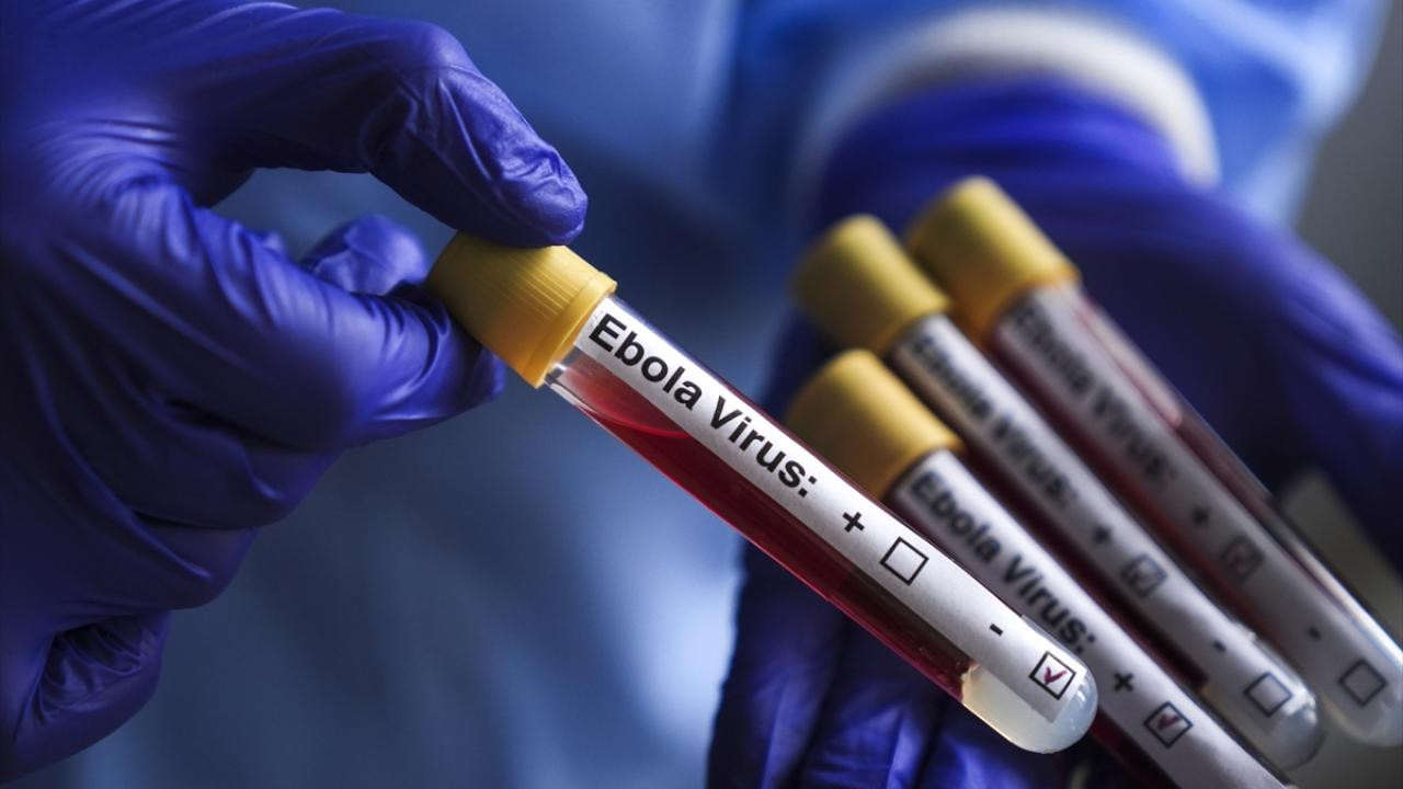 Eboladan ölənlərin sayı durmadan artır -&nbsp;3901 nəfərə çatdı