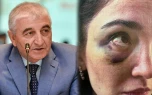 Məzahir Pənahovun oğlu arvadına işgəncə verib - Ağır ittihamlar&nbsp;