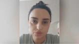 İşdən çıxarılan həkim Səhiyyə Nazirliyini belə ifşa etdi - VİDEO