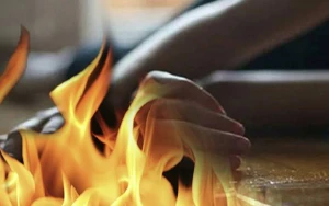 Qadın özünü yandıraraq intihar etdi