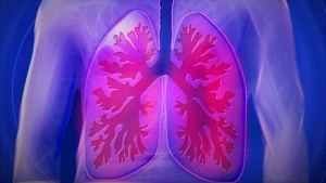 Polşada legionella bakteriyasından 16 nəfər həyatını itirdi