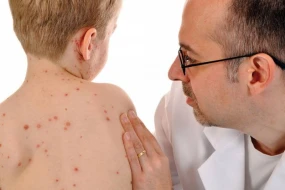 Daha bir rayonda qızılca aşkarlandı