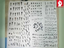 Xəstənin qarnından 3 kiloqram metal çıxarıldı