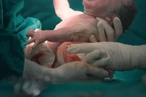 TƏBİB-dən qadının qeysəriyyə əməliyyatından sonra ölümünün səbəbi ilə bağlı AÇIQLAMA