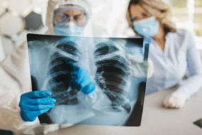 Azərbaycanda vərəm təhlükəli hal alıb? - RƏSMİ AÇIQLAMA