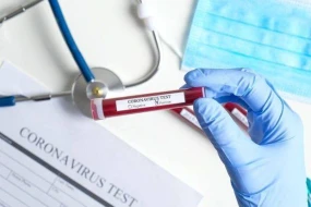 Koronavirusla bağlı son STATİSTİKA