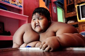 Dünyanın ən kök uşağı 114 kilo arıqladı – SON HALI (FOTO)