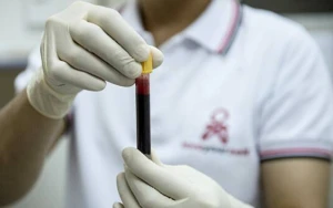 Azərbaycanda QİÇS xəstələrinin sayı AÇIQLANDI