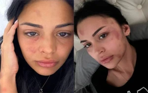 \"Məni ölümünə döyürdü, bıçaqla işgəncə verirdi” - FOTOLAR