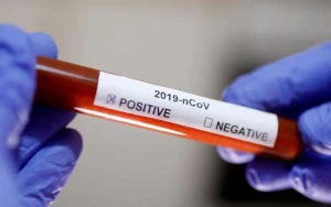 Ölkədə cəmi 17 koronavirus xəstəsi var 