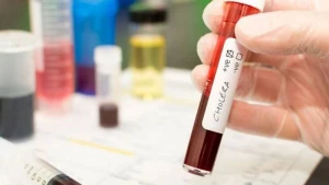 BMT-dən epidemiya ilə bağlı HƏYƏCAN TƏBİLİ - 43 ölkədə 1 milyard insan təhlükədədir
