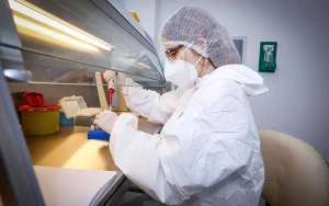 Azərbaycanda cəmi 87 koronavirus xəstəsi var 