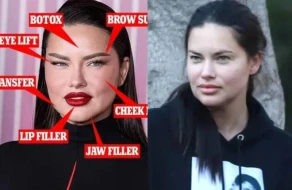 Paparasilər məşhur modelin yalanını üzə çıxardı - Foto