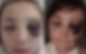 Məktəblinin döyülməsi iddiaları ilə bağlı araşdırmalara başlanıldı