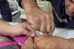 Uşağın barmağında dəmir halqası sıxışıb qaldı - VİDEO