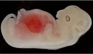 Orqan transplantasiyasında yenilik - Donuz embrionlarında insan böyrəyi yetişdirildi