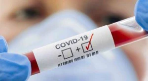 \"COVID-19-a yoluxmaların sayı artarsa, karantin tədbirləri qaçılmazdır\"- Həkim-infeksionist