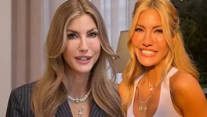 Çağla Şikelin dodaqlarındakı dəyişiklik gündəm oldu - FOTO