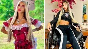 Ayaqlarını buz və duzla dolu vedrədə saxlayan fenomen artıq yeriyə bilmir - FOTO