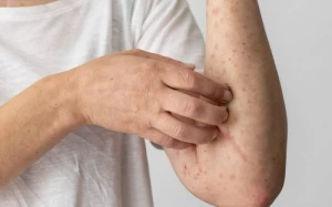 Bu ölkədə bütün uşaqlar peyvənd olunacaqlar