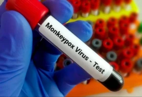 Bu ölkədə meymunçiçəyinə ilk yoluxma qeydə alındı