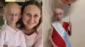 Hər ad günündə 8 yaş qocaldı - TikTok fenomeni \"152\" yaşında öldü