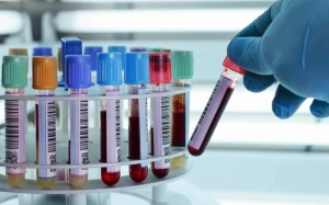 Bakının 2 qəsəbəsində hepatit virusu YAYILDI