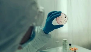 Dünyada vəba xəstəliyinə yoluxma halları artdı - ÜST