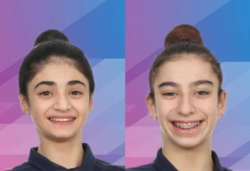 İdmançılarımız Almaniyada 2 medal qazandı